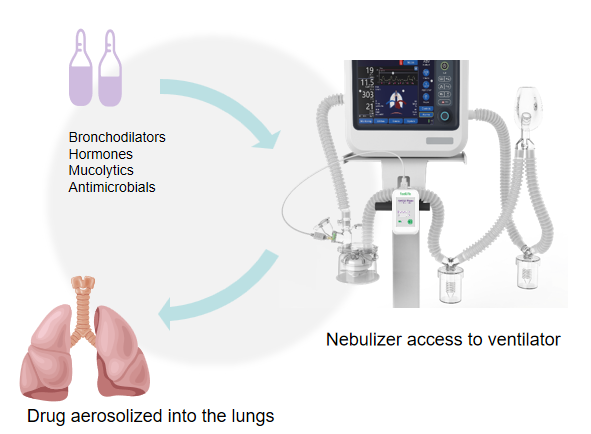 Nebulization therapy for mechanically ventilated patients